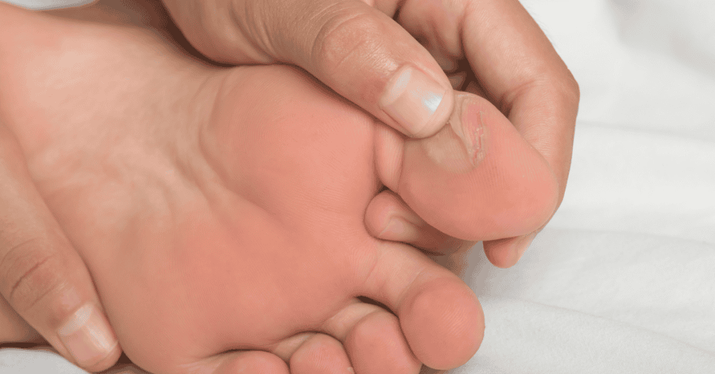 Ampollas y rozaduras en los pies de tu hijo este verano cómo curarlas bien (y cuándo NO reventarlas)